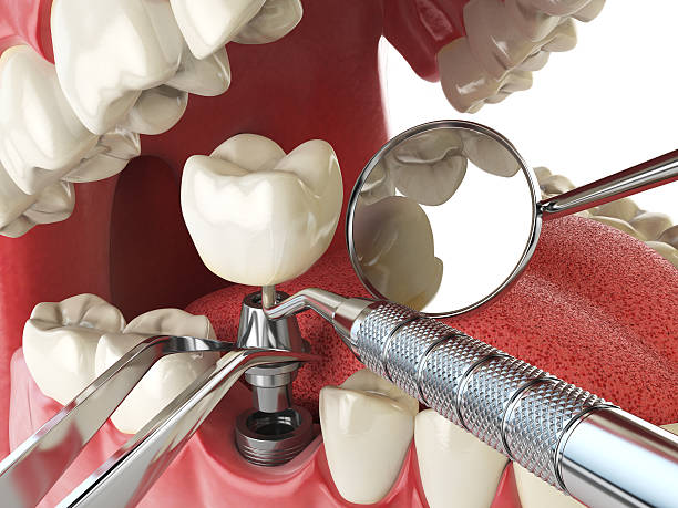 Best Emergency Treatment for Oral Infections in Bay, AR