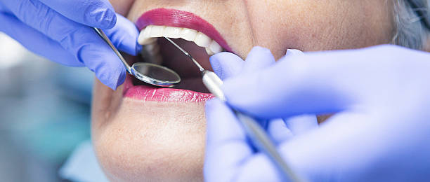 Best Emergency Wisdom Tooth Extraction in Bay, AR